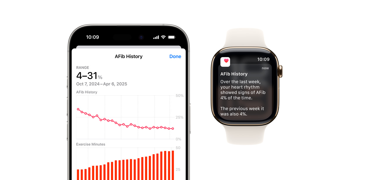 Software, die die App Vorhofflimmern-Protokoll auf dem iPhone und Mitteilungen auf der Apple Watch zeigt.